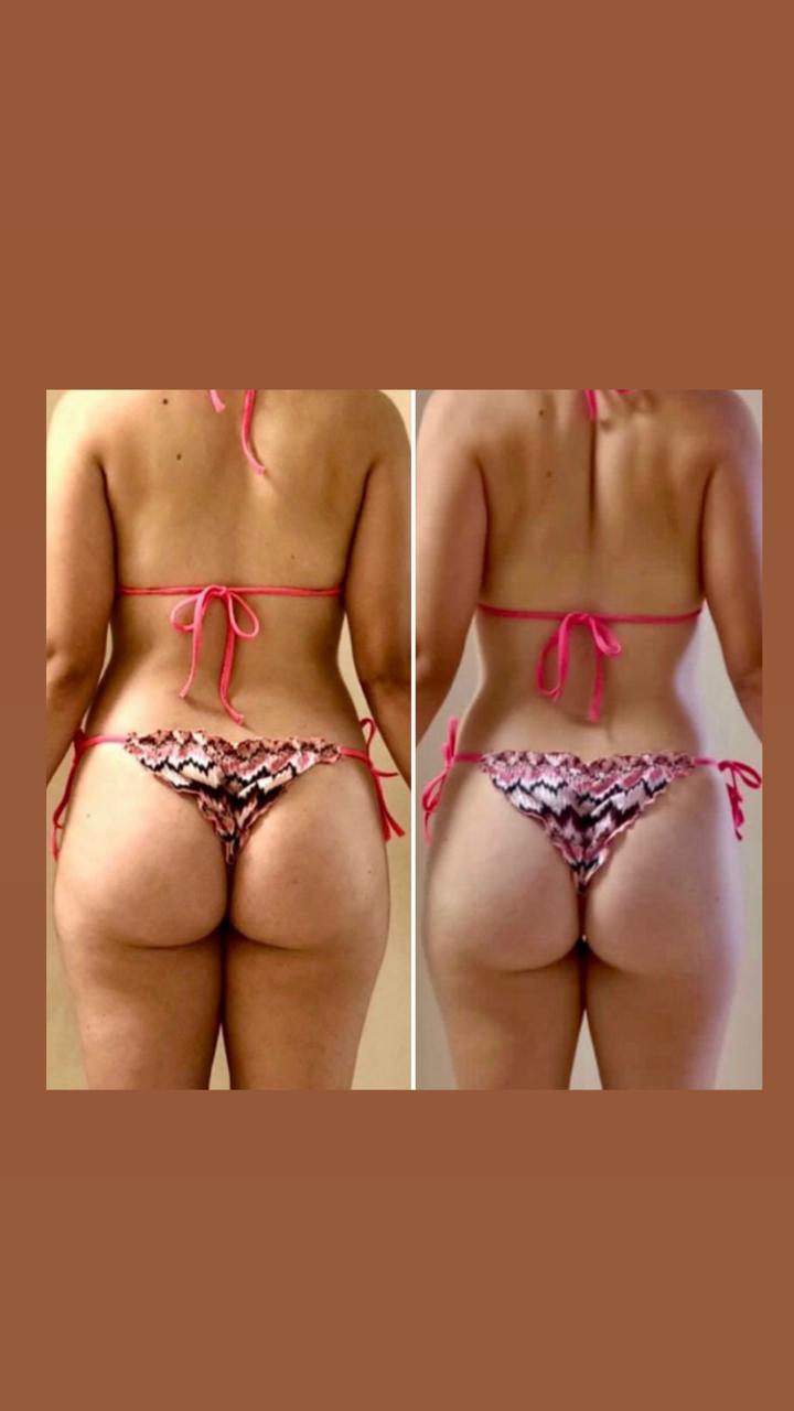 Antes e depois - programa de treinamento Fabi Felintro